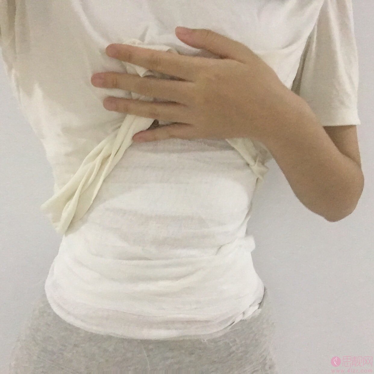 杭州西芷医疗美容吸脂怎么样?2020价格表发布+吸脂术后真人案例一览