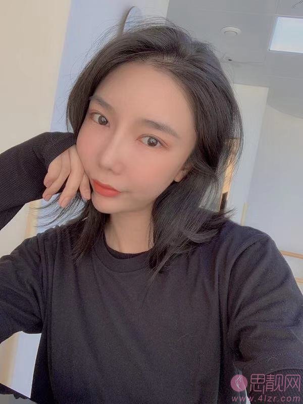 北京东方百合医疗美容门诊部王世勇做双眼皮修复怎么样？2020价格表出炉