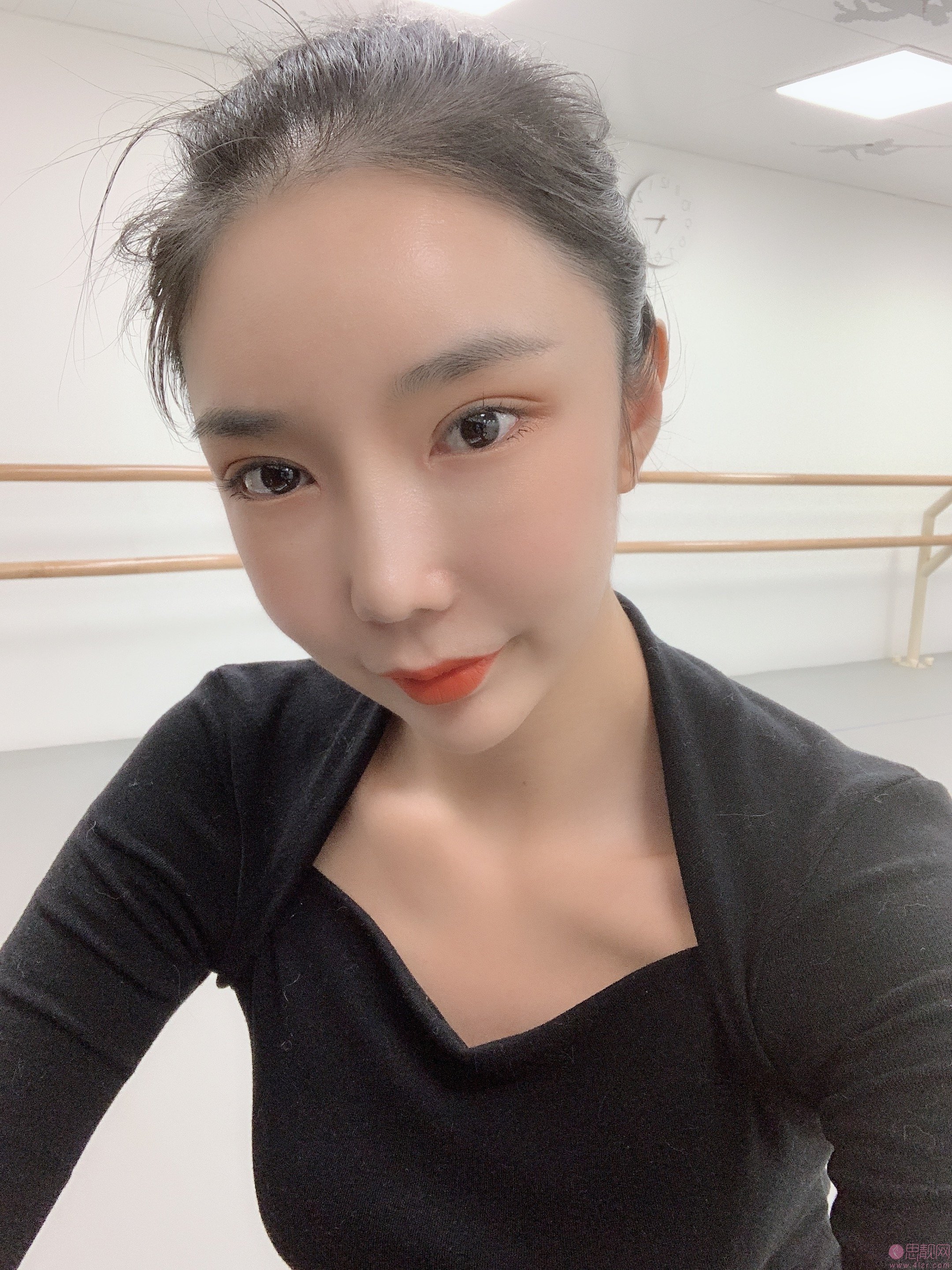 北京东方百合医疗美容门诊部王世勇做双眼皮修复怎么样？2020价格表出炉