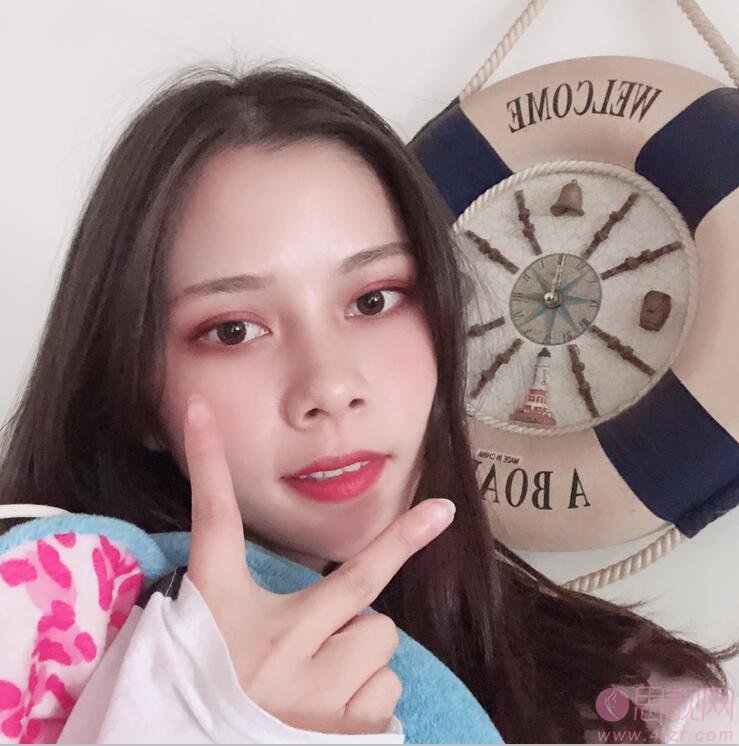 苏州爱思特美容医院做双眼皮手术好不好?2020价格表曝光+双眼皮术后真人案例分享