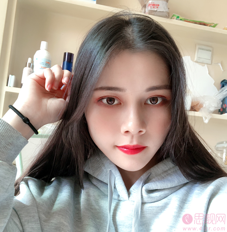 苏州爱思特美容医院做双眼皮手术好不好?2020价格表曝光+双眼皮术后真人案例分享
