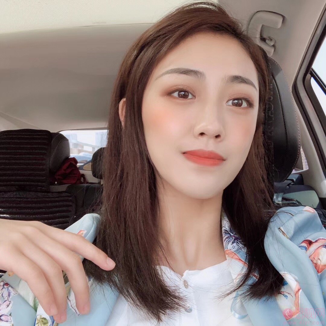 武汉漾颜医疗美容门诊部张德春做热玛吉效果好不好？2020价格表发布+案例分享