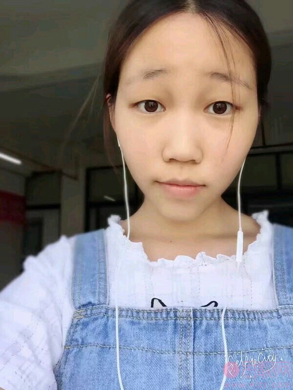 德阳德美医疗美容门诊部做双眼皮效果好不好?2020价格表上线