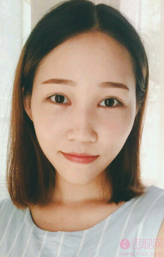德阳德美医疗美容门诊部做双眼皮效果好不好?2020价格表上线
