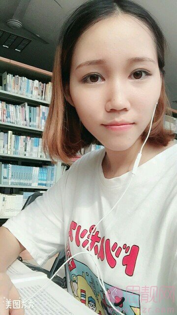 德阳德美医疗美容门诊部做双眼皮效果好不好?2020价格表上线