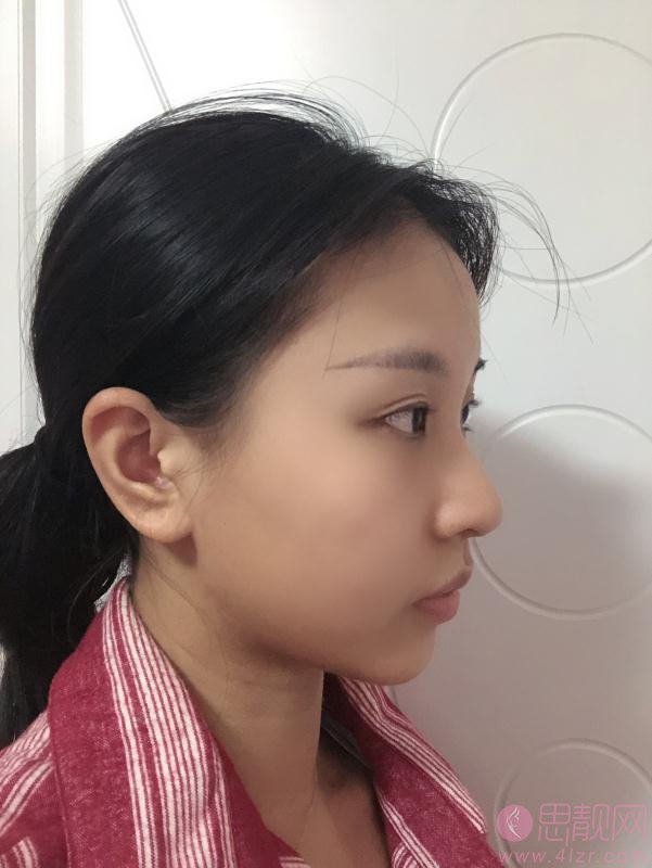 南充华美名媛医疗美容2020价格表一览+注射瘦脸案例分享