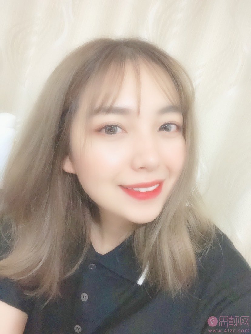 上海盈美医疗美容门诊部杨璐做双眼皮好不好？2020价格表发布