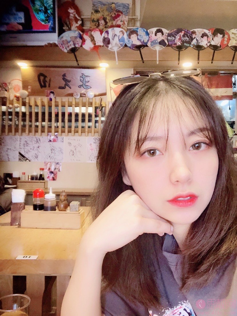 上海盈美医疗美容门诊部杨璐做双眼皮好不好？2020价格表发布