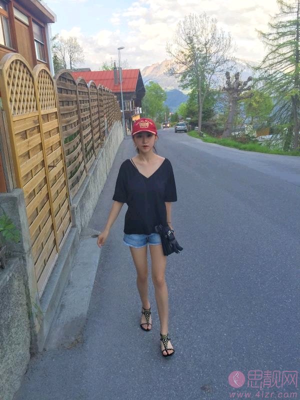 天津维美医疗美容医院张红栓吸脂瘦大腿好不好？2020价格表公开
