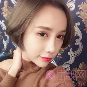 武汉同济医院整形隆鼻好不好?附隆鼻真人案例一览及2020价格表曝光