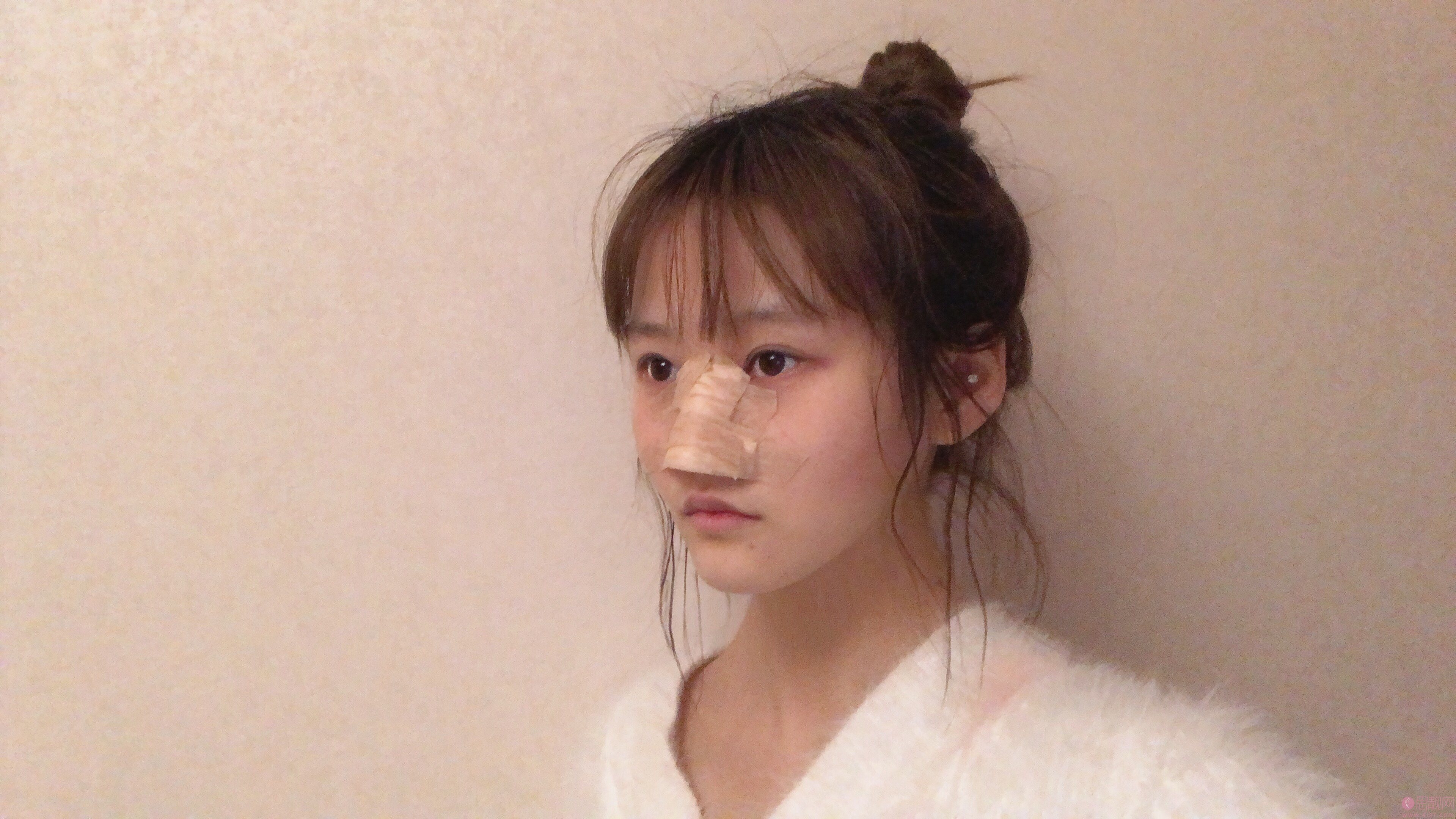 常州美莱医疗美容医院隆鼻好不好？2020价格表发布+隆鼻真人案例一览