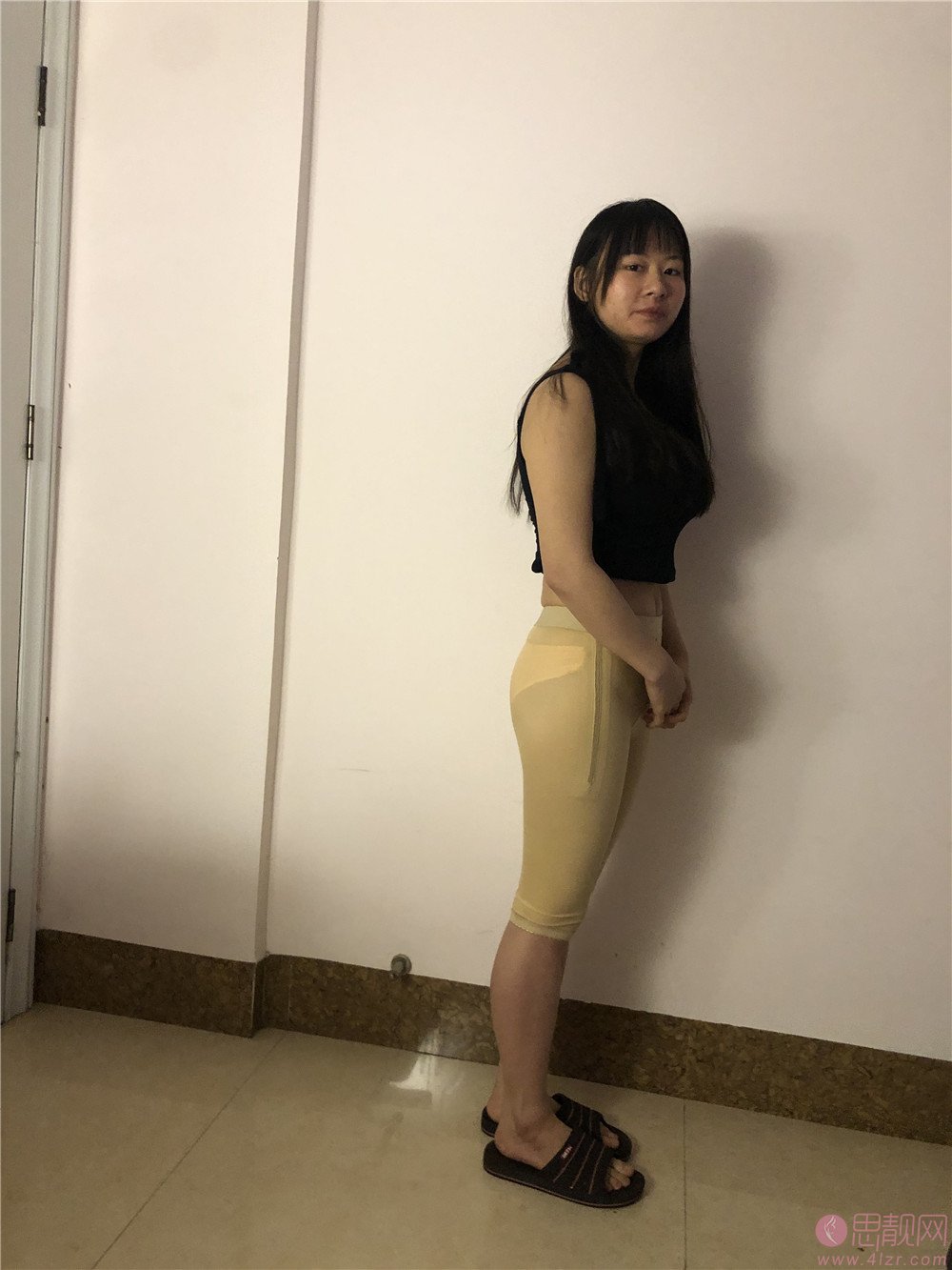 北京华真堂医疗美容吴宇宏做吸脂手术好不好？2020价格表曝光+吸脂真人案例一览