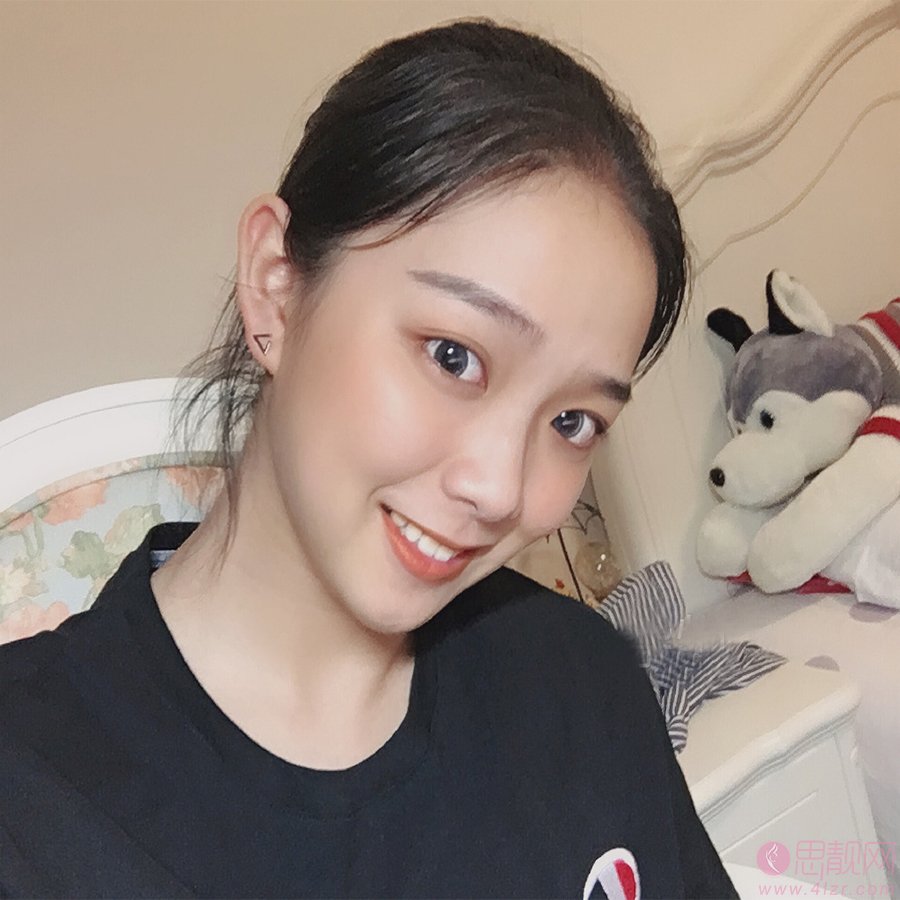 成都青白江好美康口腔诊所牙齿美白怎么样?2020价格表曝光+牙齿美白真人案例一览