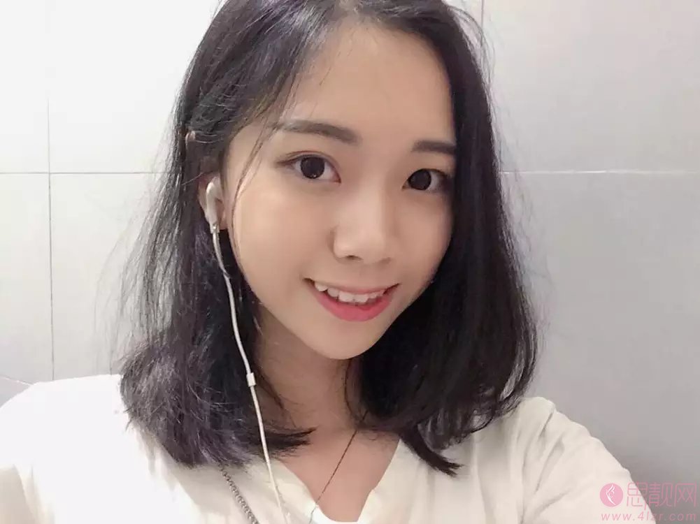 成都舒雅口腔矫正牙齿好不好?附矫正案例一览
