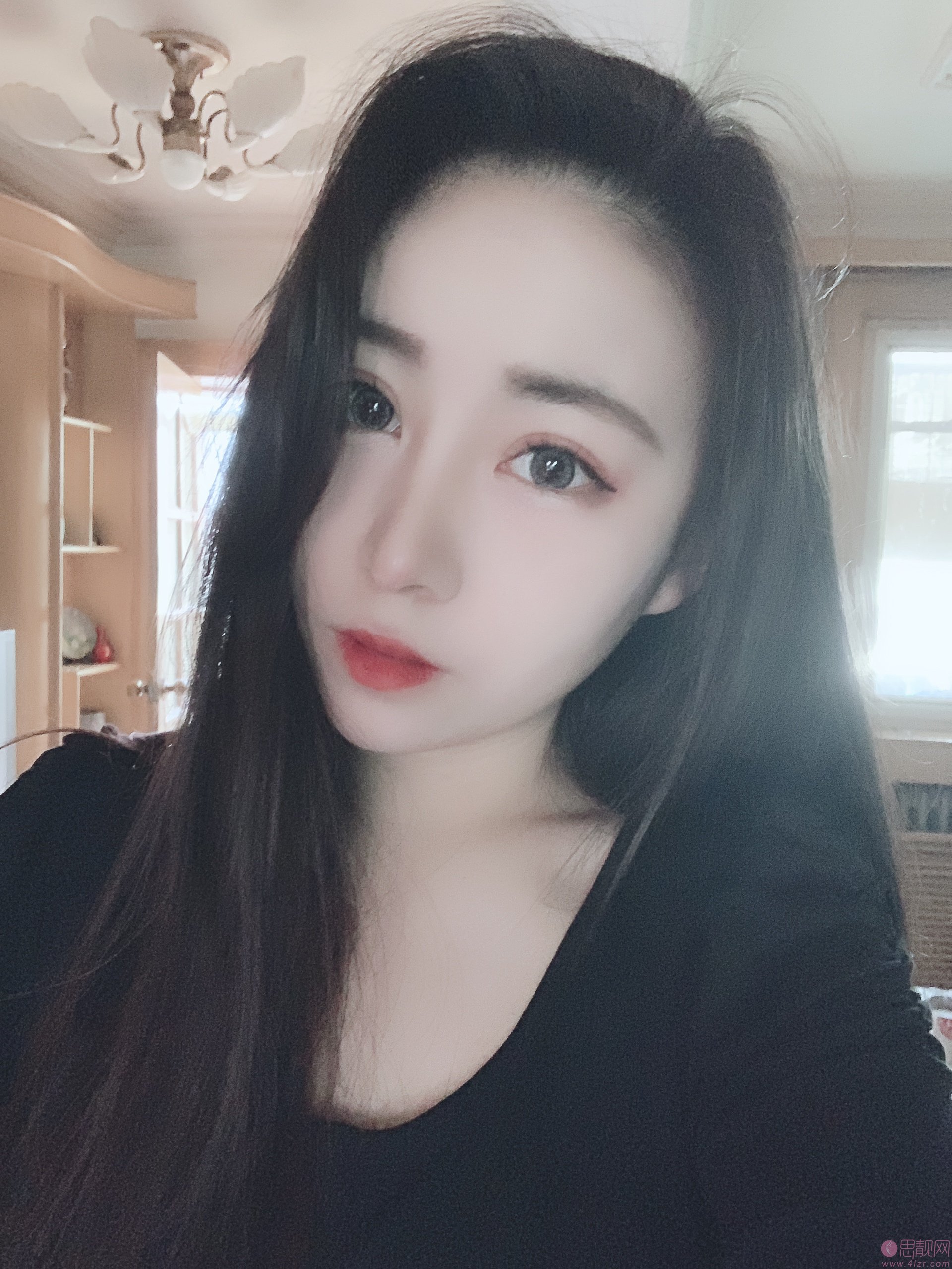 天津伊美尔医疗整形美容专科医院隆鼻怎么样？附隆鼻案例一览及2020价格表曝光