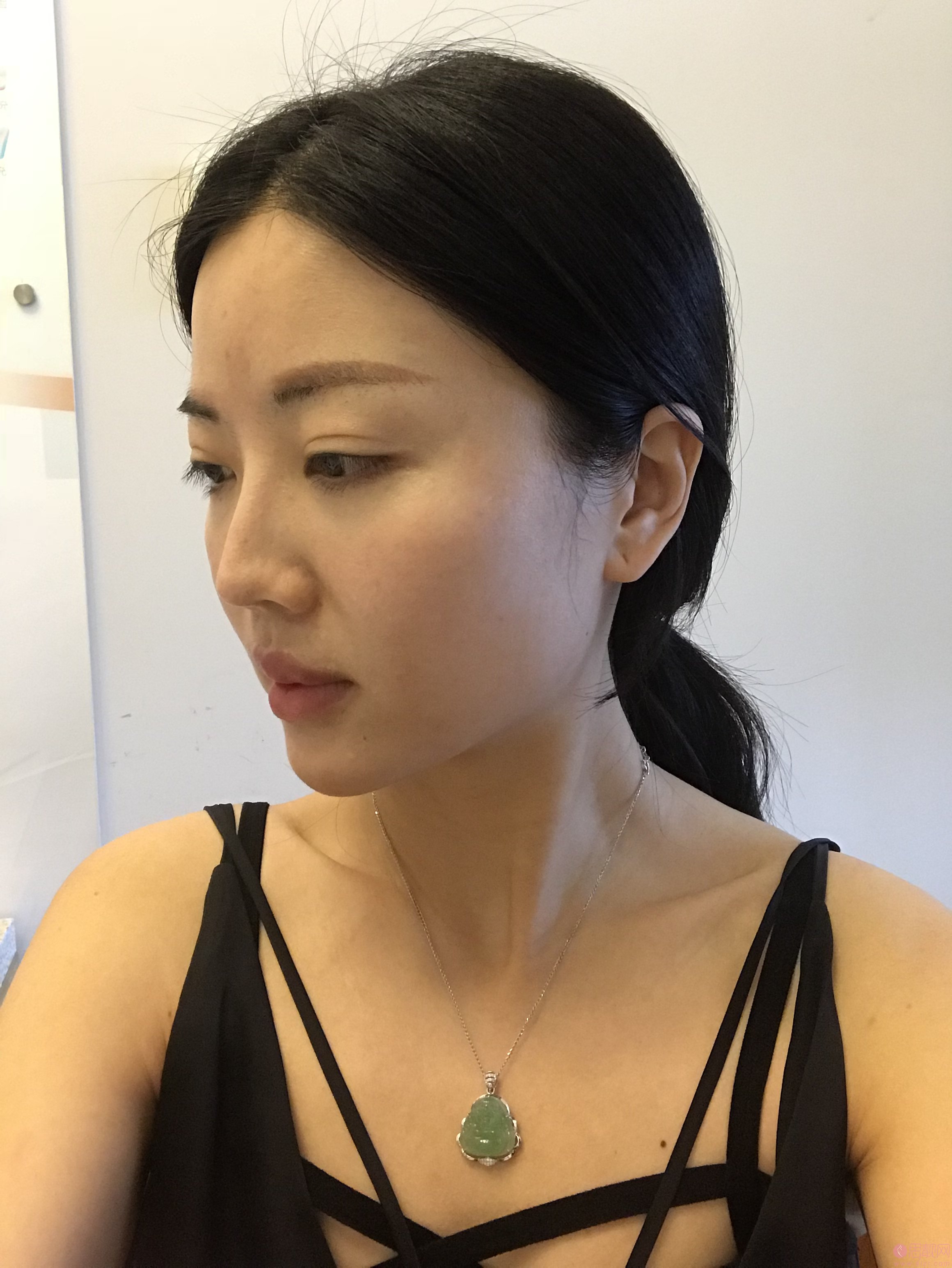 心悦容医疗美容门诊部倪云志做鼻修复好不好？2020价格表曝光