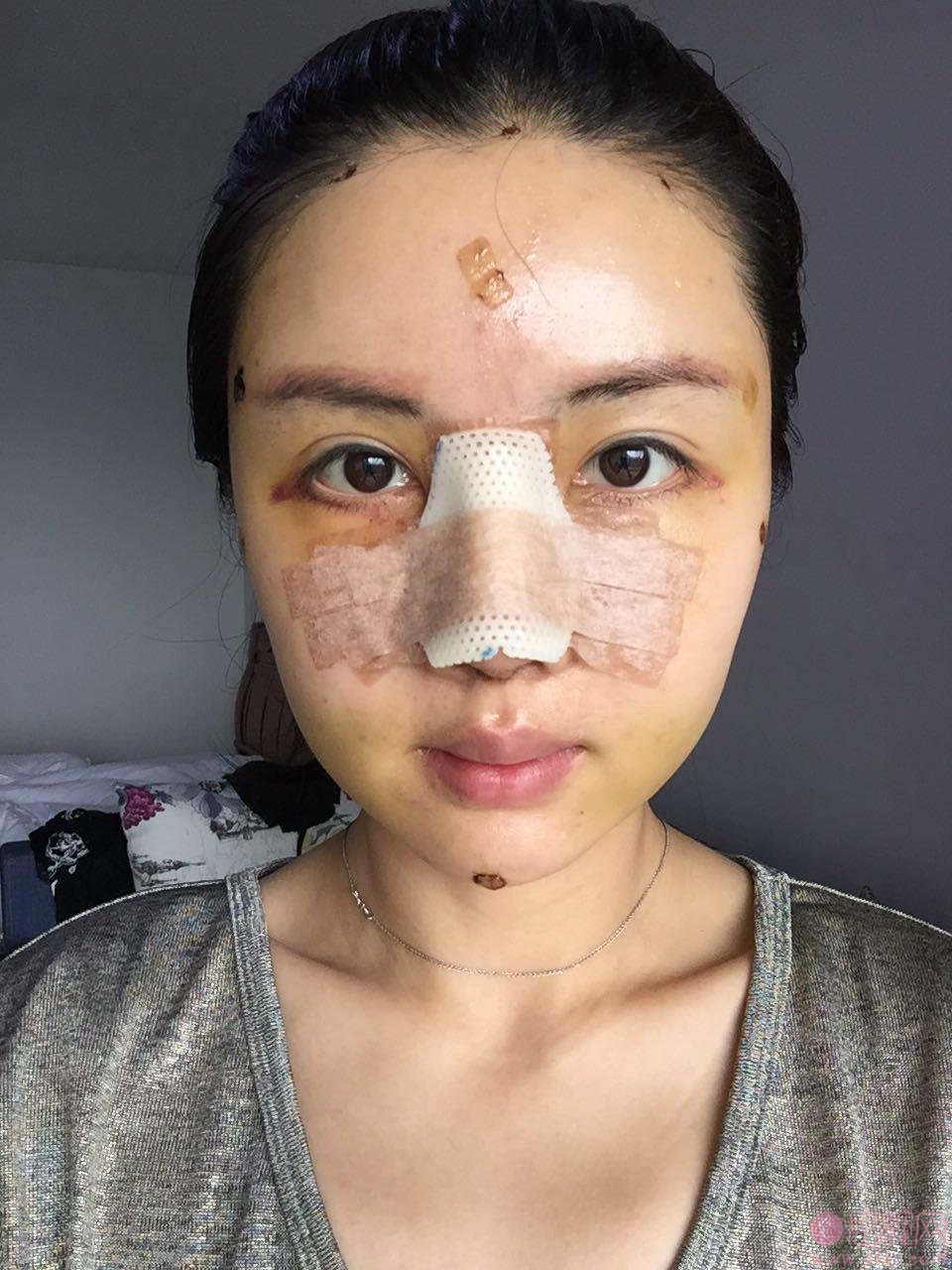 心悦容医疗美容门诊部倪云志做鼻修复好不好？2020价格表曝光