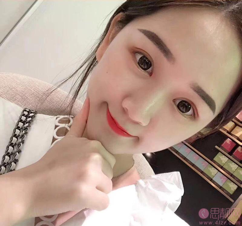 无锡坤如玛丽整形美容医院2020价格表曝光+双眼皮真人案例分享