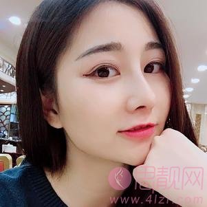 深圳艾妍医疗美容门诊部徐荣阳做隆鼻手术怎么样？2020价格表曝光+隆鼻真人案例一览