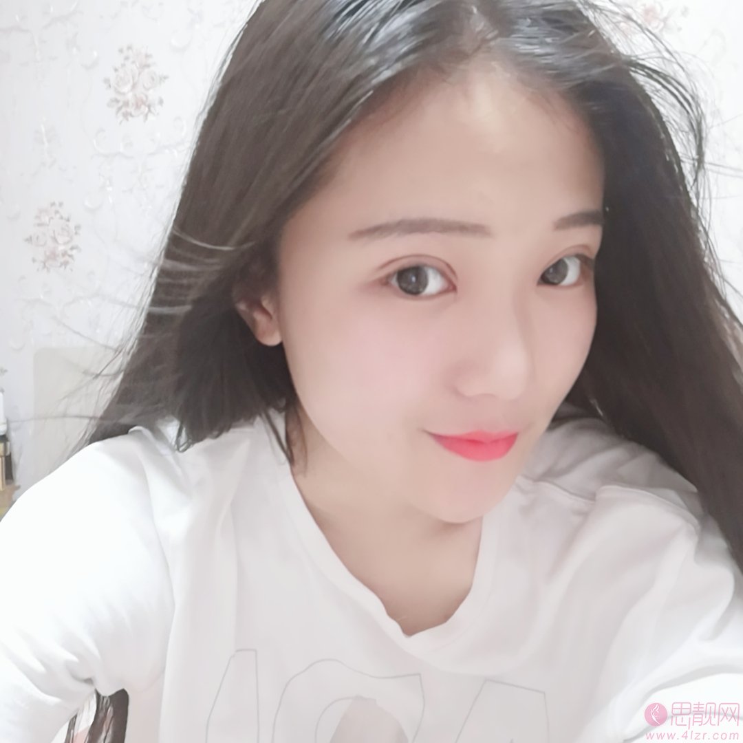广州韩后医疗美容做双眼皮手术怎么样？2020价格表曝光+双眼皮真人案例分享