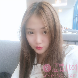 广州韩后医疗美容做双眼皮手术怎么样？2020价格表曝光+双眼皮真人案例分享