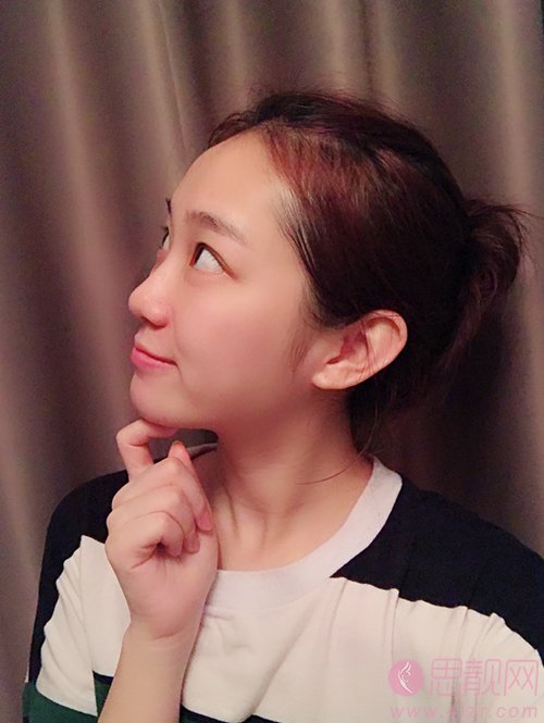 成都正好医学美容医院2020价格表公布+隆鼻真人案例一览