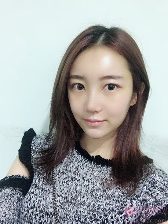 成都正好医学美容医院2020价格表公布+隆鼻真人案例一览