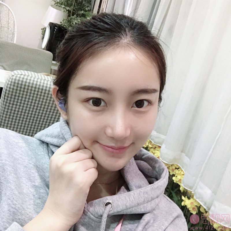 成都正好医学美容医院2020价格表公布+隆鼻真人案例一览