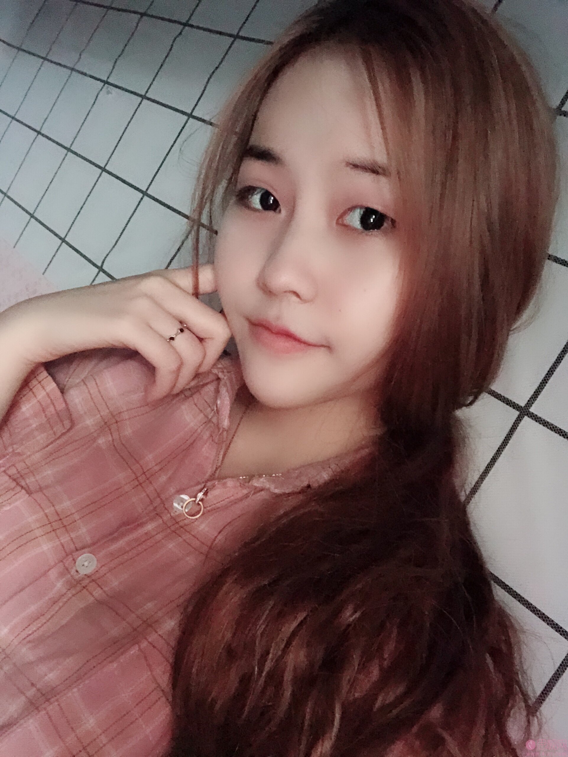 成都珍妍医疗美容门诊部2020价格表发布+双眼皮真人案例一览