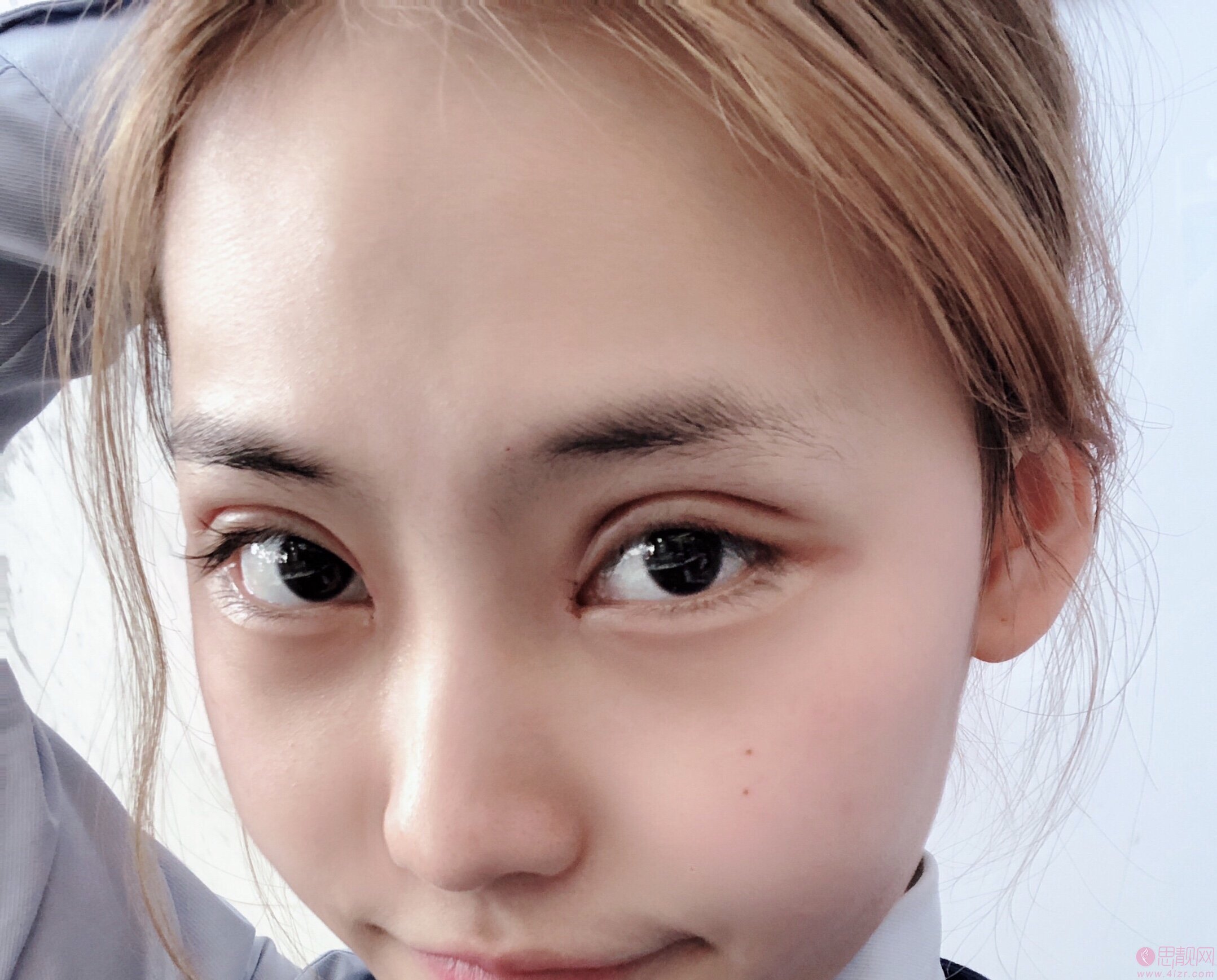 成都珍妍医疗美容门诊部2020价格表发布+双眼皮真人案例一览