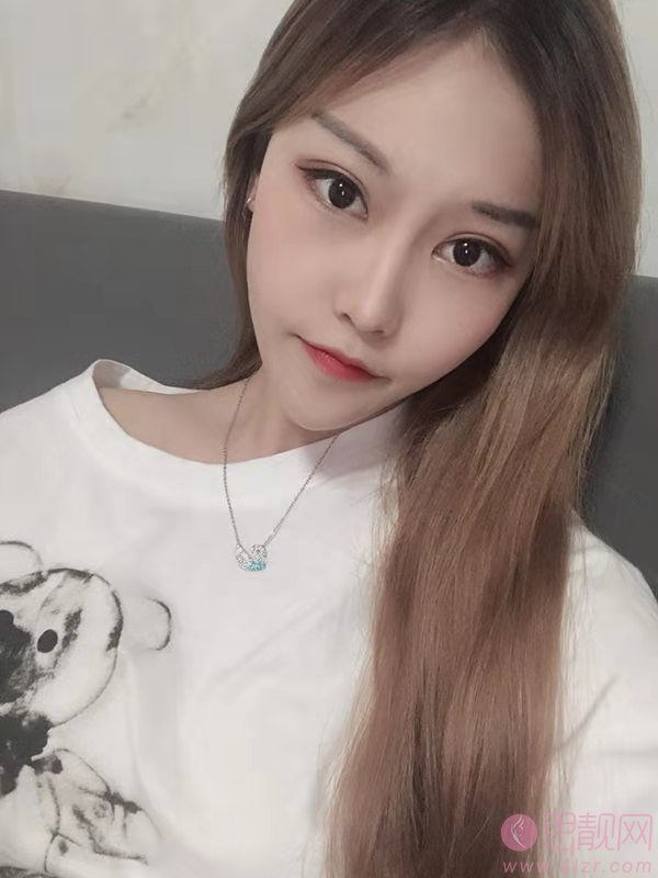 成都珍妍医疗美容门诊部2020价格表发布+双眼皮真人案例一览