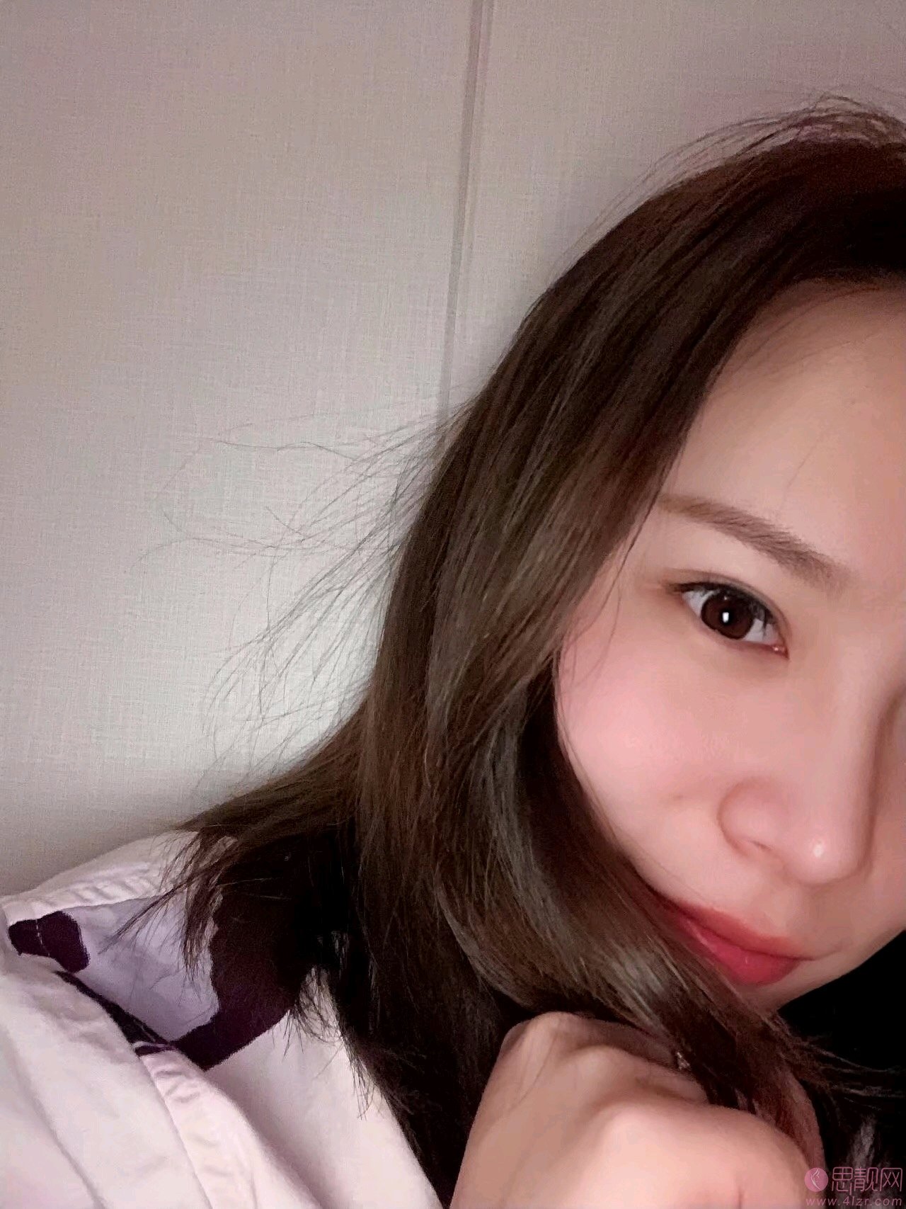 广州军区总医院整形科肖强怎么样?附双眼皮案例及2020价格表一览