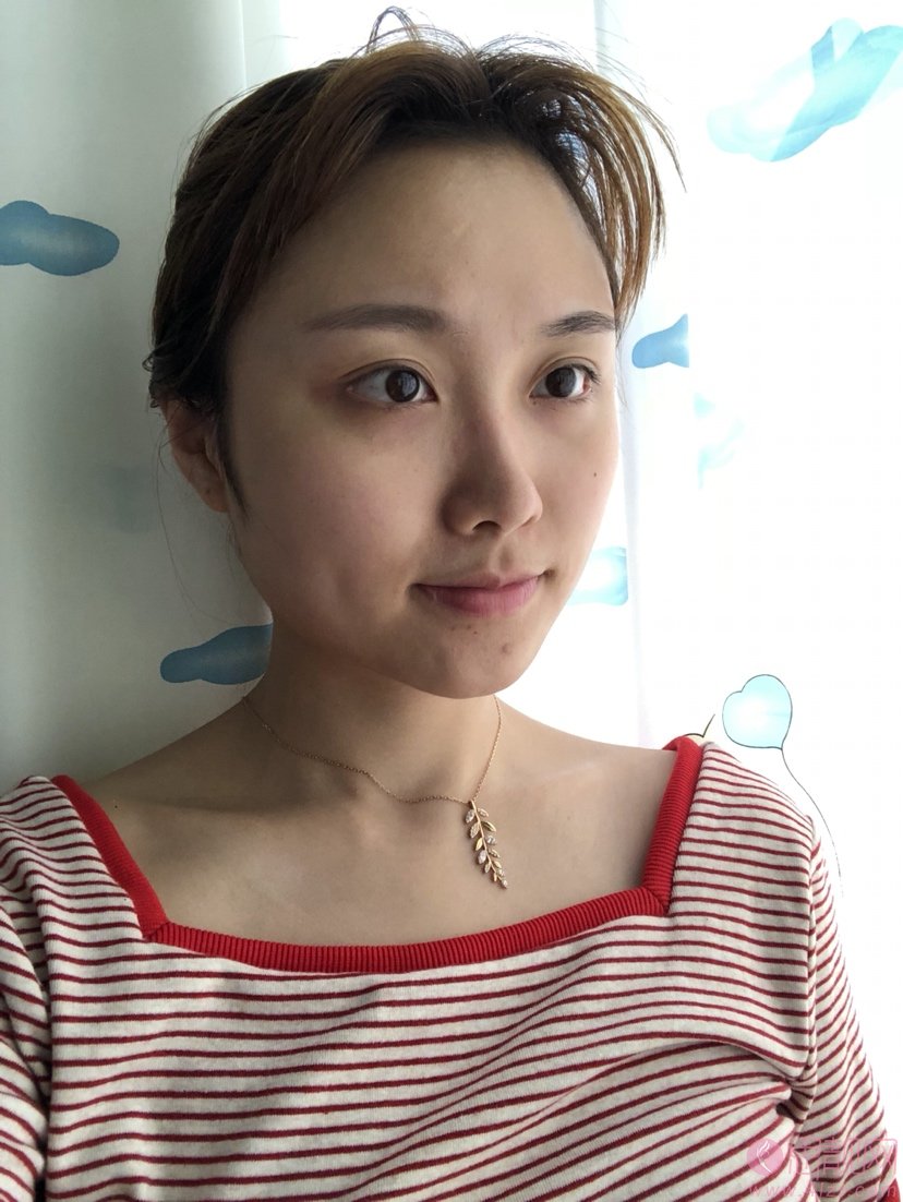 广州军区总医院整形科隆鼻怎么样？附隆鼻真人案例一览