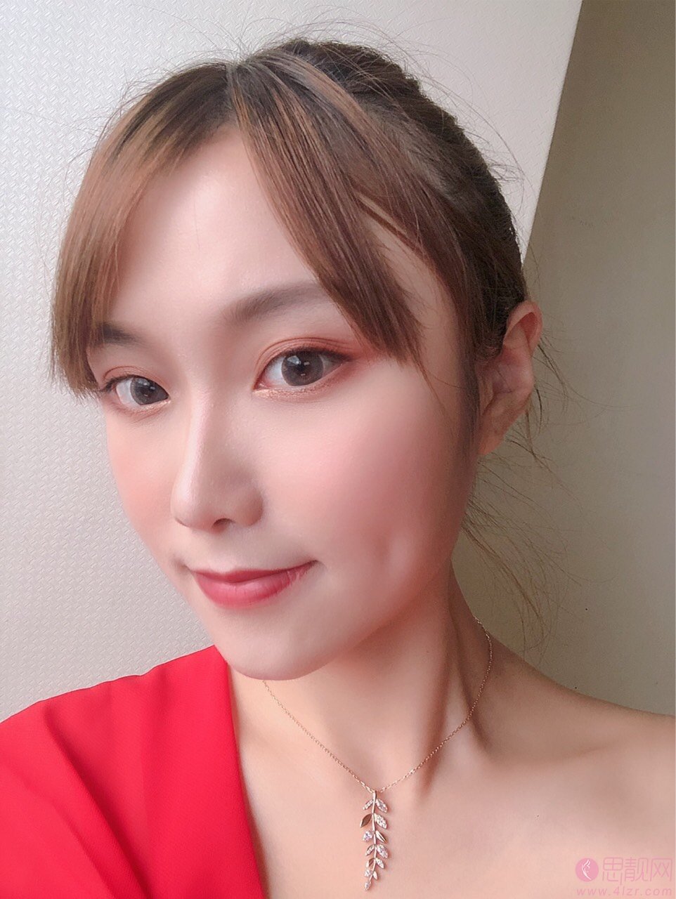 广州军区总医院整形科隆鼻怎么样？附隆鼻真人案例一览