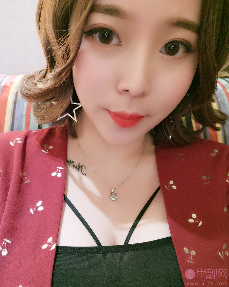 山东省立医院整形美容科霍然做双眼皮怎么样?附双眼皮案例及2020价格表曝光