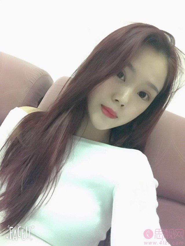 上海东方医院整形美容科做双眼皮手术怎么样?2020价格表曝光+双眼皮真人案例一览