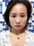 上海仁济医院整形价格曝光+磨骨案例分享