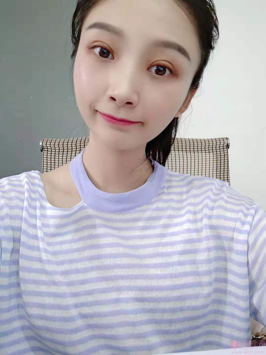 深圳北大医院做双眼皮多少钱？2020价格表曝光+双眼皮真人案例分享