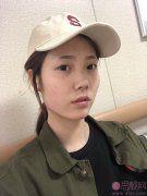 四川省人民医院整形外科磨骨怎么样、附磨骨案例及2020价格表公开