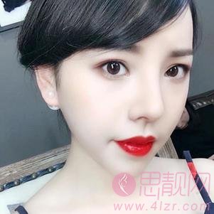 贵阳美莱医疗美容医院隆鼻怎么样?附隆鼻案例及2020价格表一览