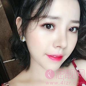 贵阳美莱医疗美容医院隆鼻怎么样?附隆鼻案例及2020价格表一览