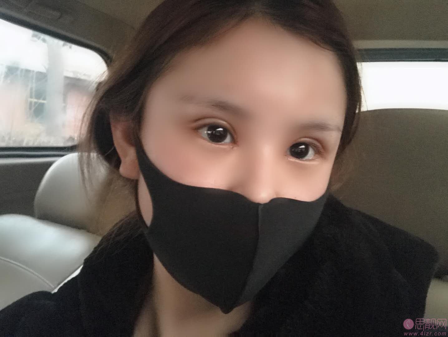 洛阳孔繁荣医疗美容门诊部孔繁荣做双眼皮手术怎么样？附2020价格表公布