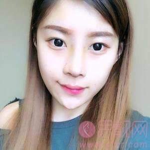 大连明医汇整形美容刘崴隆鼻好不好？附隆鼻前后案例对比及2020价格表曝光