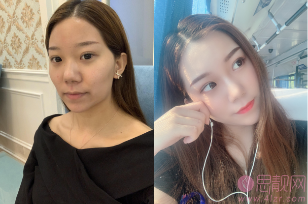 武汉大学中南医院整形美容外科好不好？