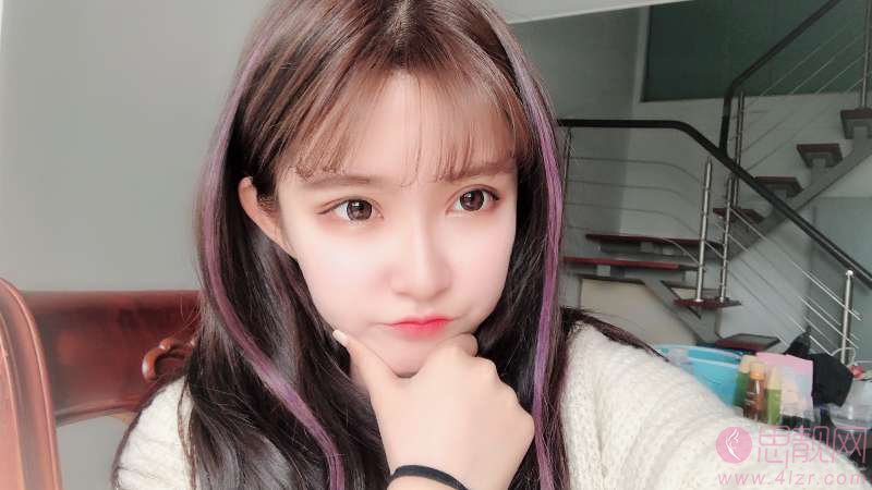 北京同仁医院整形美容中心双眼皮案例一览及2020价格表公开