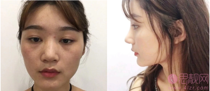 石河子大学医学院第一附属医院整形美容外科怎么样？