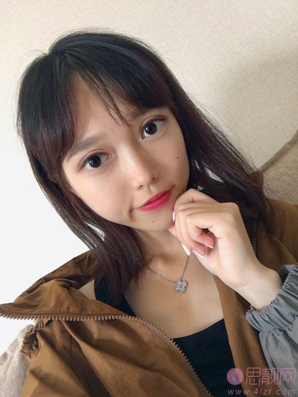 成都八大处于晓波做双眼皮怎么样？附双眼皮案例及2020价格表公开