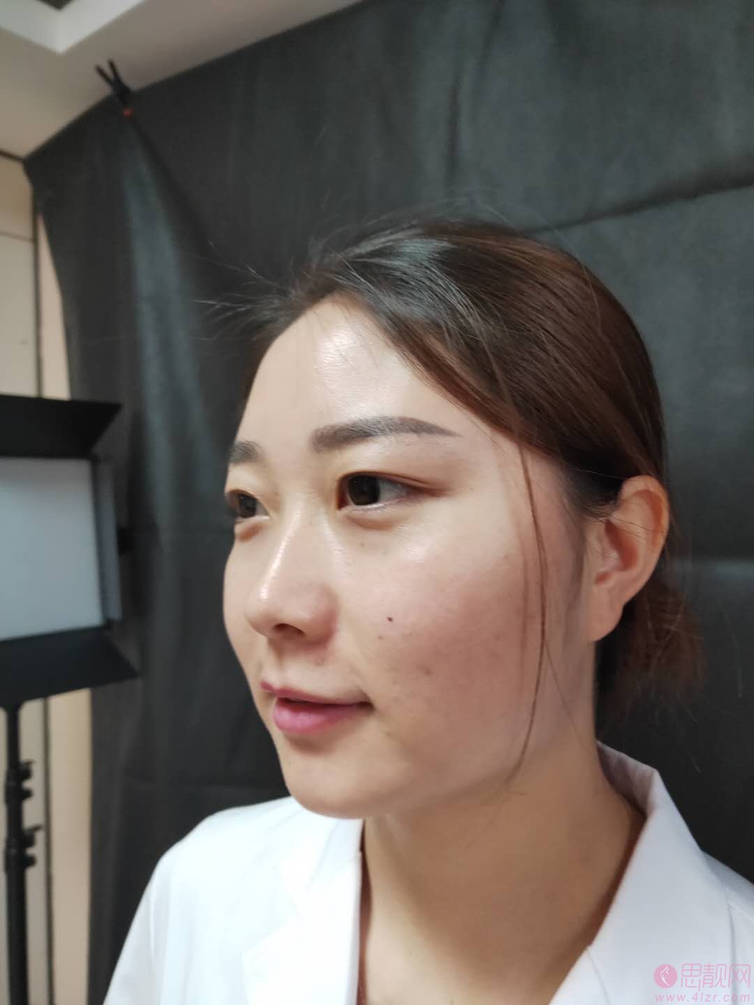 成都刘辅容眼部修复怎么样？附双眼皮案例一览及2020价格表出炉