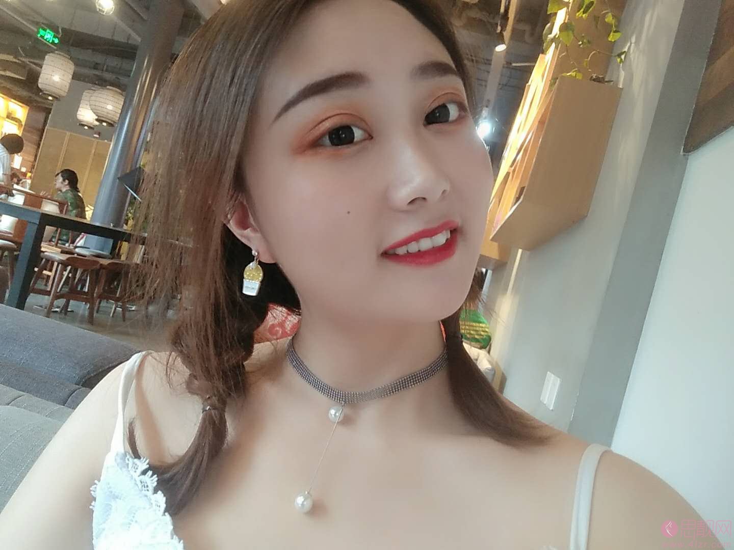 成都刘辅容眼部修复怎么样？附双眼皮案例一览及2020价格表出炉
