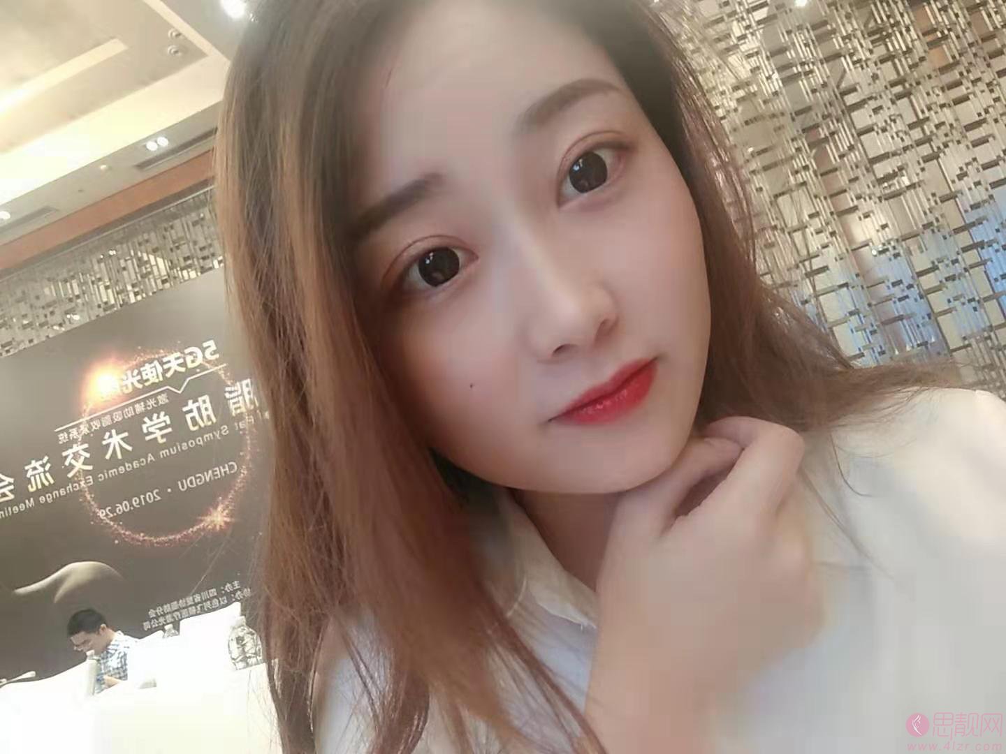 成都刘辅容眼部修复怎么样？附双眼皮案例一览及2020价格表出炉